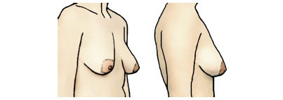 Рисунок неполной женской груди