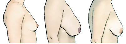 Полная верхняя часть женской груди