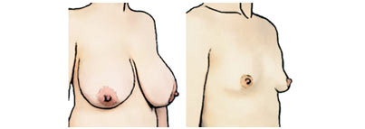 Рисунок женской груди с сильно выступающими сосками